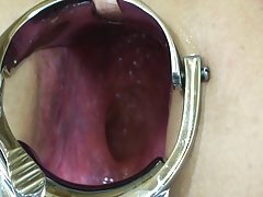 3 角质菲律宾